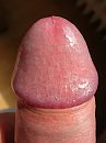 dikke eickel, foto 1944x2592, 1 reacties, 3 stemmen