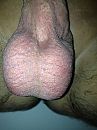 mijn ballen, foto 480x640, 0 reacties, 3 stemmen