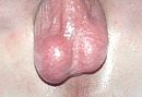 mijn ballen, foto 426x292, 0 reacties, 5 stemmen