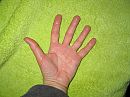 Magische massagehanden, foto 2592x1944, 1 reacties, 4 stemmen