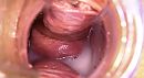 Speculum, foto 707x390, 2 reacties, 12 stemmen