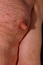 een van mijn grote tepels, foto 2000x3008, 4 reacties, 9 stemmen