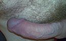 erg close up, foto 1870x1170, 0 reacties, 0 stemmen