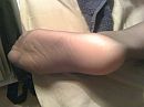 feet in nylon, foto 1600x1200, 0 reacties, 4 stemmen