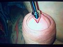 plug, foto 2048x1536, 0 reacties, 0 stemmen