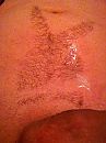 Bunny is verkouden, foto 480x640, 1 reacties, 8 stemmen
