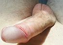 Penis, foto 2304x1666, 1 reacties, 6 stemmen