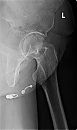 Radiologie 1, foto 415x692, 3 reacties, 87 stemmen