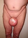 Saline ballon, foto 1200x1600, 0 reacties, 4 stemmen