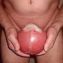 Saline ballon, foto 1192x1198, 4 reacties, 6 stemmen
