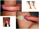 Vulprocedure, foto 960x720, 5 reacties, 9 stemmen