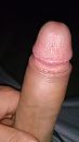dikke neukstaaf, foto 2204x3920, 1 reacties, 4 stemmen