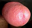 rood kopje, foto 1945x1736, 1 reacties, 1 stemmen