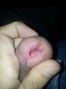 Besneden piemel, foto 2448x3264, 0 reacties, 0 stemmen
