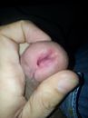Besneden piemel, foto 2448x3264, 0 reacties, 5 stemmen