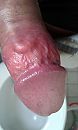 Blote eikel, foto 1536x2560, 3 reacties, 5 stemmen