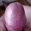 Eikel., foto 1367x1375, 1 reacties, 7 stemmen