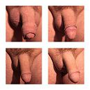 pikken, foto 404x404, 1 reacties, 2 stemmen