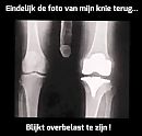 X-foto knieen..., foto 720x690, 1 reacties, 4 stemmen