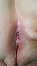 anaal neukgat, foto 720x1280, 2 reacties, 10 stemmen