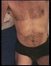 body before, foto 319x408, 0 reacties, 2 stemmen