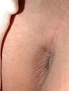 open en bloot, foto 548x714, 1 reacties, 8 stemmen