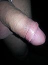 Eikel zichtbaar, foto 2448x3264, 0 reacties, 4 stemmen