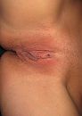 Haar nieuwe piercing, foto 1230x1727, 3 reacties, 37 stemmen