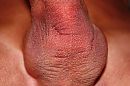 kale ballen, foto 4000x2666, 0 reacties, 2 stemmen