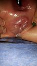 Anus pomp 2, foto 2250x4000, 5 reacties, 24 stemmen
