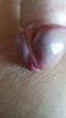 Mijn gezwollen eikel, foto 2250x4000, 0 reacties, 0 stemmen