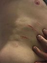 Scratches, foto 769x1024, 1 reacties, 7 stemmen