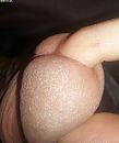 Vinger In de Dop, foto 2057x2430, 3 reacties, 8 stemmen