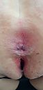 volgespoten aars, foto 622x1280, 10 reacties, 42 stemmen