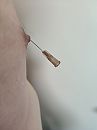 Naald., foto 960x1280, 2 reacties, 2 stemmen