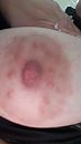 Nipplepic, foto 1080x1920, 1 reacties, 9 stemmen