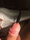 Sounding - dilator, foto 2448x3264, 13 reacties, 34 stemmen