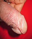 eikel, foto 1171x1397, 3 reacties, 6 stemmen