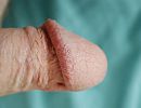 mijn eikel, foto 2281x1761, 1 reacties, 8 stemmen