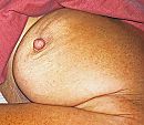 the left nipple, foto 2200x1928, 2 reacties, 9 stemmen