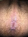 Behaard mannen kontje destijds, foto 2448x3264, 2 reacties, 6 stemmen