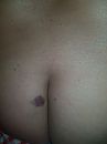 Blauwe, foto 3000x4000, 9 reacties, 35 stemmen