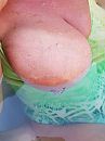 Gepiercde tepel, foto 3000x4000, 6 reacties, 38 stemmen
