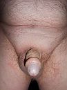 Retracted foreskin, foto 3000x4000, 2 reacties, 5 stemmen