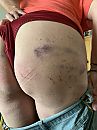 Spanking, foto 3000x4000, 12 reacties, 41 stemmen