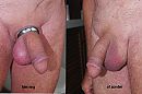 met of zonder ring, foto 4000x2666, 12 reacties, 19 stemmen