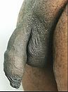 stoppels..., foto 447x595, 7 reacties, 17 stemmen