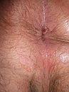 Behaarde anus, foto 3000x4000, 4 reacties, 8 stemmen