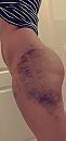 Butt, foto 1440x3020, 11 reacties, 73 stemmen