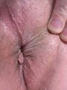 Detailopname van mijn anus, foto 2448x3264, 5 reacties, 9 stemmen